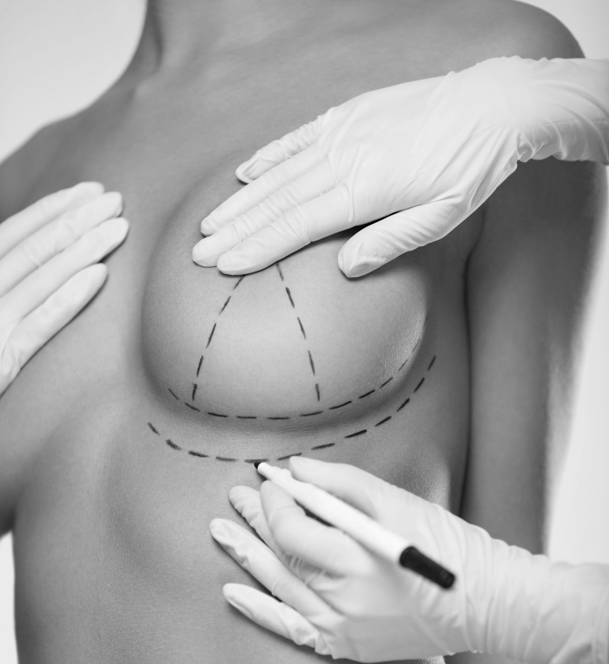 aumento mamario en cdmx  precio 2024