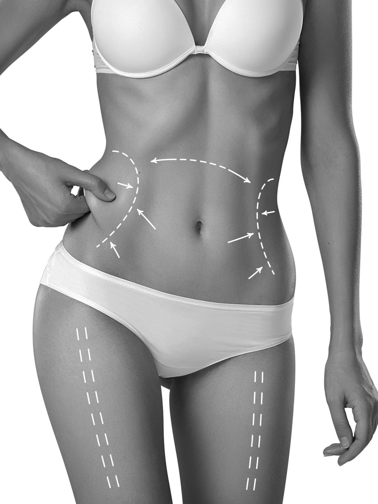 liposuccion vaser en cdmx  precio 2024